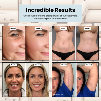 Silune™ Scar & Wrinkle Solution Silicone Stick